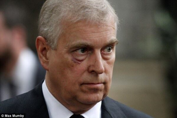 A black eye for Prince Andrew